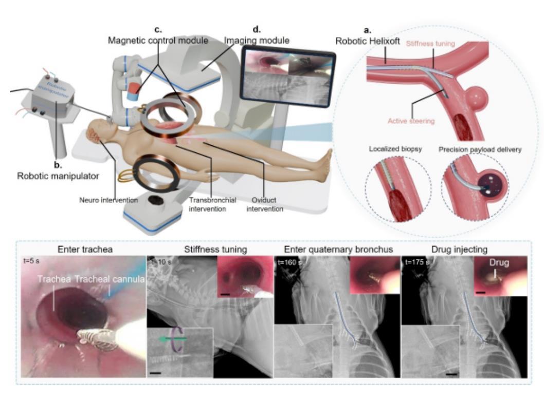 中国科学院磁控微米机器人导管研究取得进展